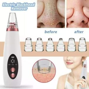 blackhead remover