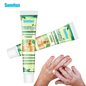 Vitiligo treatment cream