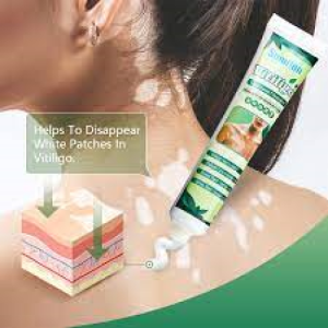 Vitiligo treatment cream